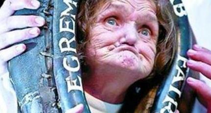世界上最丑陋的人 62岁的安妮·伍兹(面部表情丑哭你)